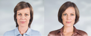 sculptra in charleston
